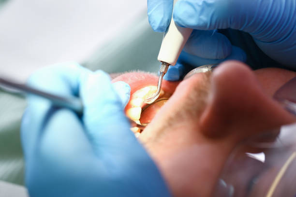 Best Walk-In Emergency Dental Services in Swepsonville, NC