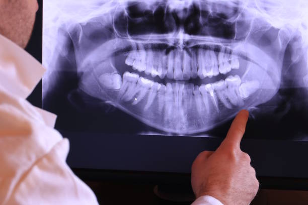 Best Weekend Emergency Dental Services in Swepsonville, NC