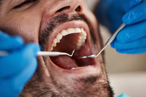 Best Dental Abscess Treatment in Swepsonville, NC